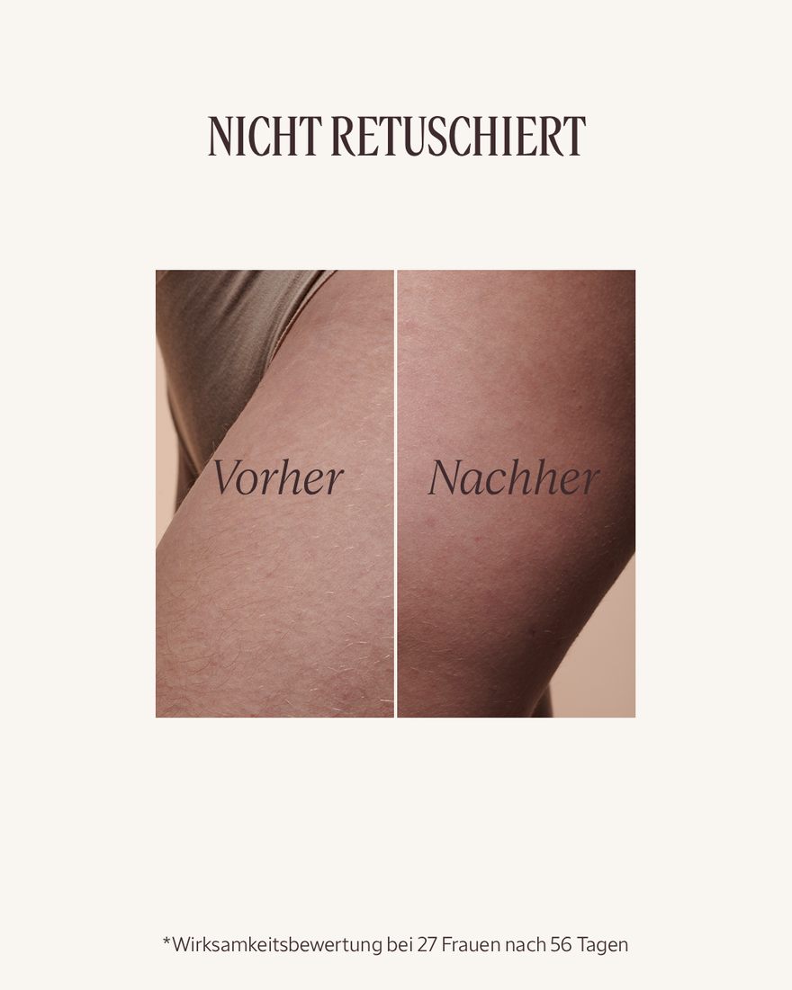 Bildanzeige 3/11 des Produkts Mandel Straffendes K&ouml;rper&ouml;l, , RECT